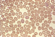 Babiesa spp.jpg