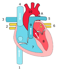 Coarctation.png