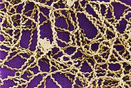 Leptospira scanning micrograph.jpg