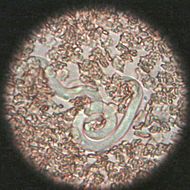 Microfilaria.jpg