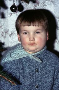 Mumps.jpg