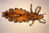 Pediculus humanus var capitis.jpg