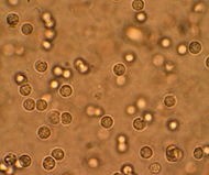 Pyuria.JPG