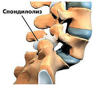 Spond 01.jpg