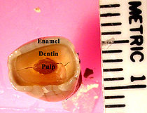 Topviewtooth.jpg