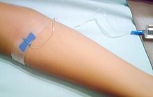 Injection 23.JPG