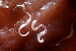 Ancylostoma caninum на слизистой кишечника