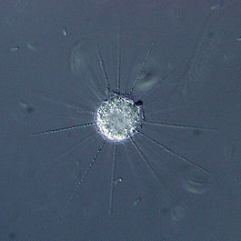 Raphidiophrys contractilis.jpg