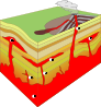 Intrusion types.svg